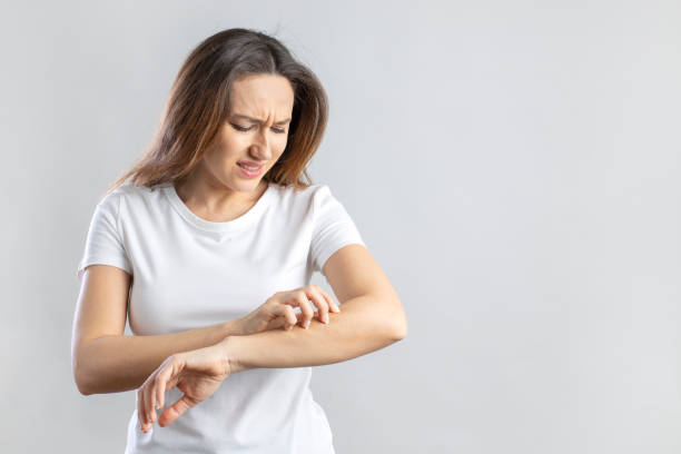 Young woman scratching her itchy arm stock photo