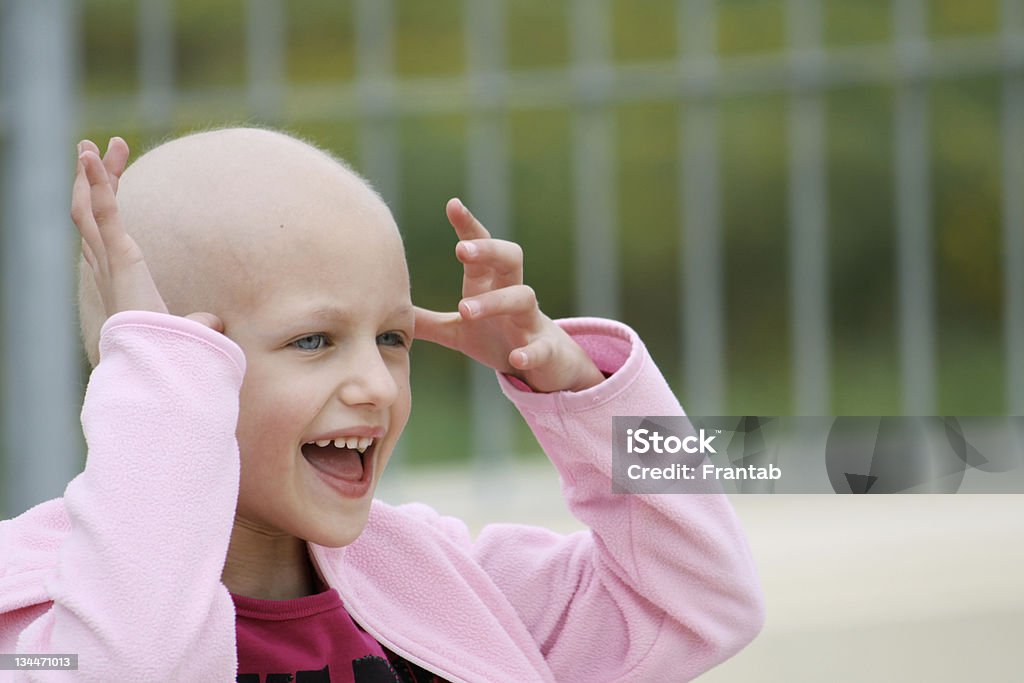 child with cancer happy child who lost her hair due to chemotherapy to cure cancer Cancer - Illness Stock Photo