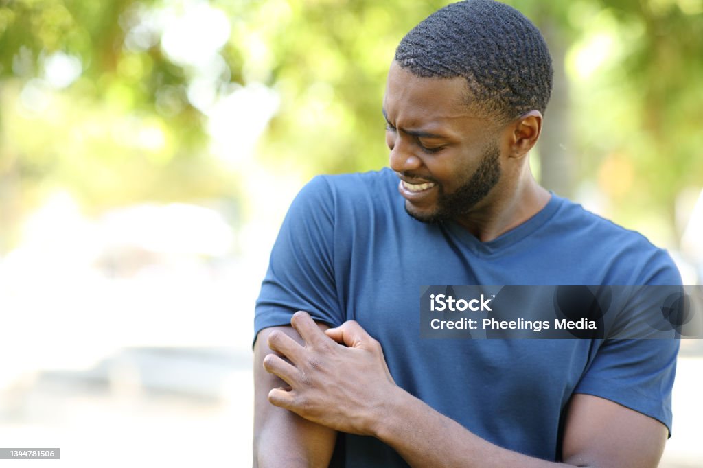 Black man scratching itchy arm in a park Scratching Stock Photo