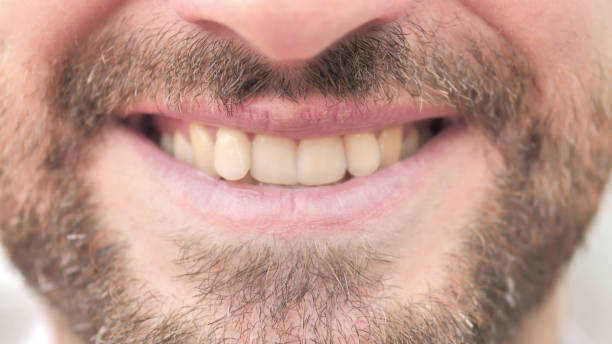 istock Close up of Smiling Man Lips and Teeth 1344819552