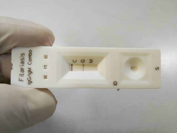 Rapid test kit for Filariasis antibody IgG, IgM test. Showing result IgG positive. Rapid test kit for Filariasis antibody IgG, IgM test. Showing result IgG positive at medical laboratory. malaria blood sample stock pictures, royalty-free photos & images