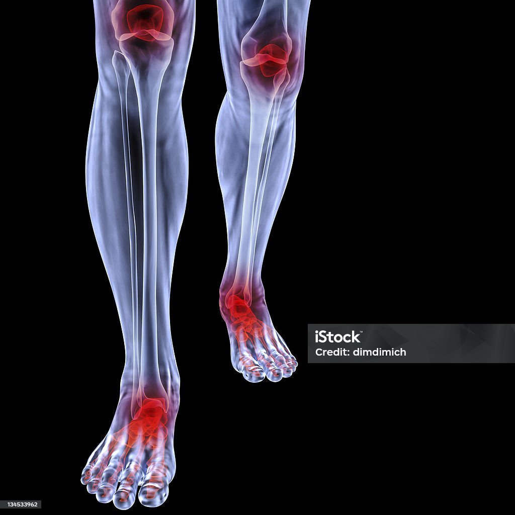 Umane radiografia delle gambe e piedi. - Foto stock royalty-free di Immagine a raggi X