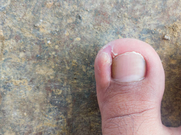 adult man thumb nails isolated on concrete floor stock photo