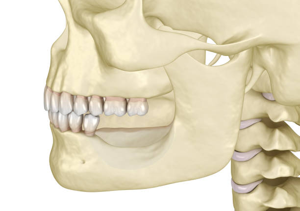 istock Mandibular Jaw, bone recession after losing molars teeth. Medically accurate dental 3D illustration 1345444959