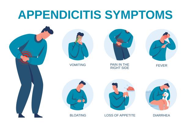 ilustrações, clipart, desenhos animados e ícones de sintomas de apendicite infográfico, sinais de diagrama de inflamação do apêndice. dor abdominal, diarreia, vômito. folheto médico vetorial - diarreia