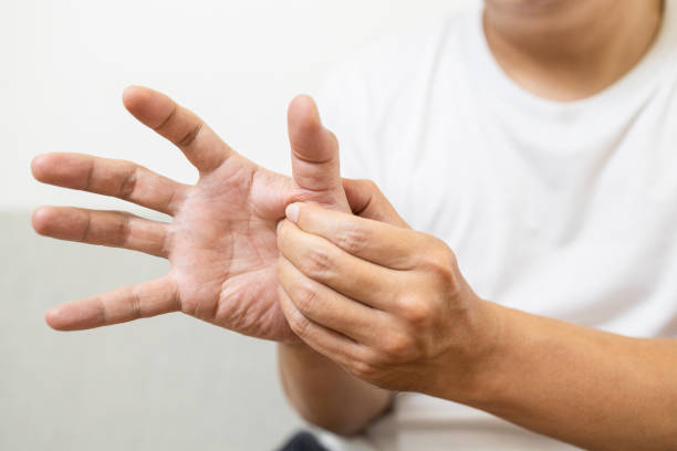 middle-aged man suffering from de quervain's disease,numbness or beriberi of palms and fingertips,male patient with trigger finger disease,finger to jerk,weakness and painful in hand,health problems - finger on the trigger imagens e fotografias de stock