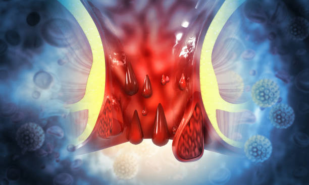 hemoroidy (stosy) na tle naukowym. ilustracja 3d - hemorrhoid zdjęcia i obrazy z banku zdjęć