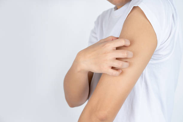 istock Young woman scratching arm from having itching on white background. 1345472366