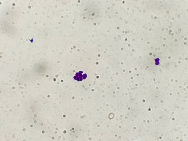 곰팡이 식민지 그램 얼룩 미세 한 100 x 쇼 곰 팡이 칸디다 알비칸 - bacterium staphylococcus colony epidemic 뉴스 사진 이미지