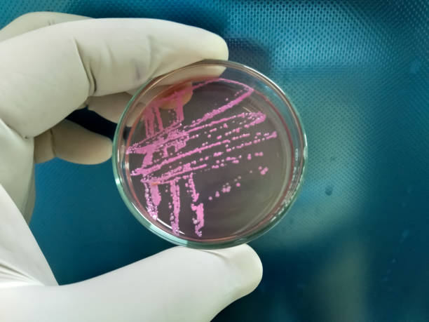 istock Stool Culture and Sensitive test on Salmonella Shigella (SS) Agar medium. 1345476667