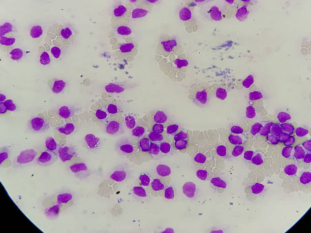 istock Blood smear Microscopic image of Chronic Mylohyoid Leukemia (CML). 1345477461