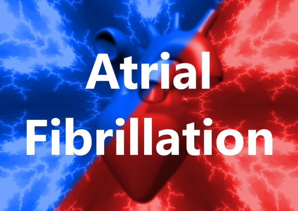 fibrilación auricular por letra, ritmo cardíaco anormal del corazón humano. - fibrillation fotografías e imágenes de stock