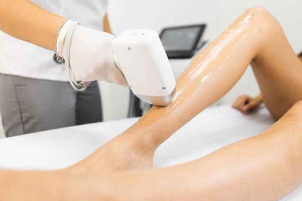 istock Laser hair removal process for woman's legs 1345531872