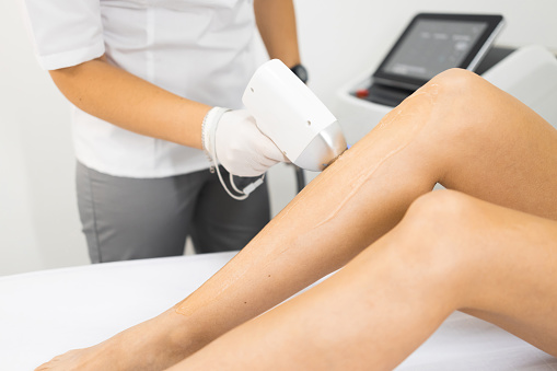 Laser hair removal procedure on a woman's legs