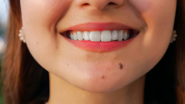 unrecognizable young woman with straight white teeth smiling at camera unrecognizable young woman with straight white teeth smiling at camera, close-up snow white and the seven dwarfs photos stock pictures, royalty-free photos & images
