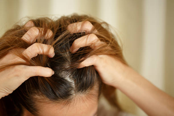A woman has problems with hair and scalp stock photo