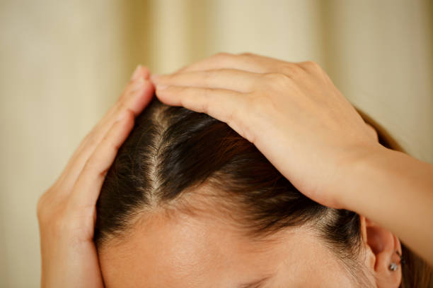 istock A woman has problems with hair and scalp 1345605357