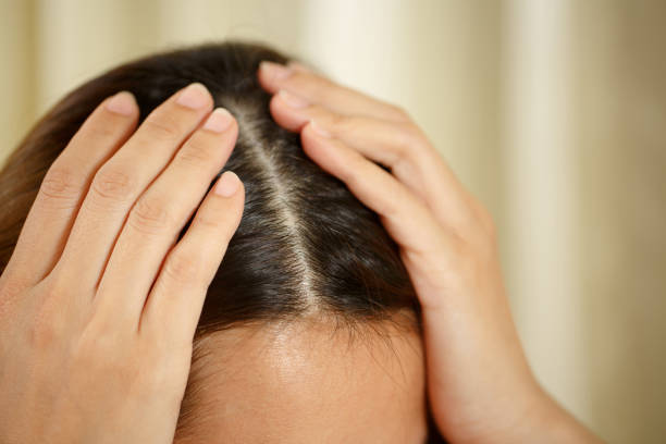 istock A woman has problems with hair and scalp 1345605366