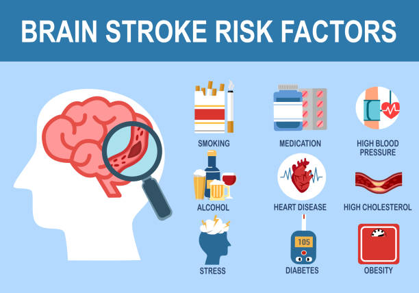 stockillustraties, clipart, cartoons en iconen met brain stroke risk factors infographic in flat design. - beroerte