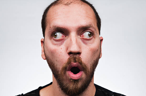 schielen mann - cross eyed men adult making a face stock-fotos und bilder