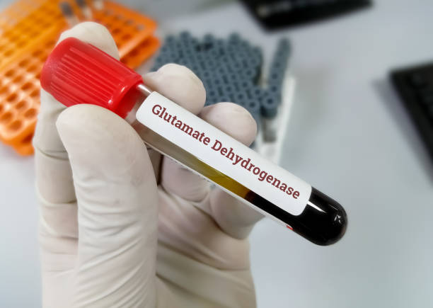 istock Scientist hold blood sample for Glutamate dehydrogenase (GDH) test with lab background 1345705177