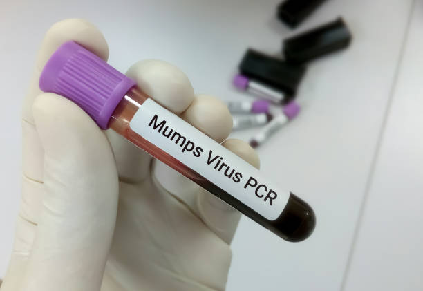 biólogo molecular tem amostra de sangue para teste de pcr do vírus da caxumba. fundo desfocado - human parainfluenza virus - fotografias e filmes do acervo