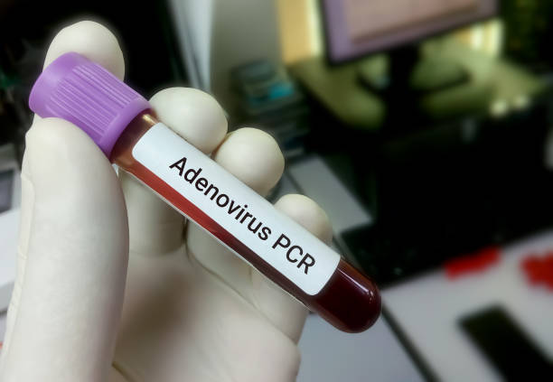 Biologist hold blood sample with blur background for Adenovirus PCR test stock photo