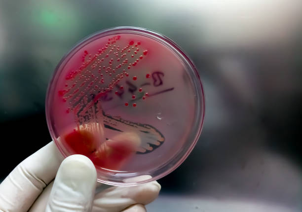 istock Colonies of bacteria in MacConkey agar (culture medium plate). petri dish 1345761103