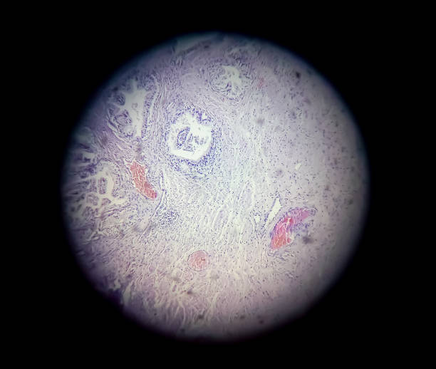 mikroskopijny widok z bliska zabarwionego szkiełka histologii. cytopatologia. mikroskopia. - cytopatologia zdjęcia i obrazy z banku zdjęć