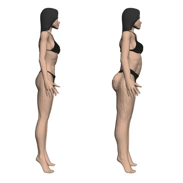 Vector illustration of Two model girls in underwear, a slim and fat girl. The process of obesity of the girl body. Side view. 3D. Vector illustration