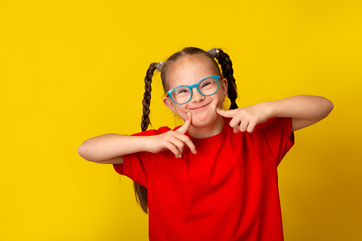 Happy girl with Down syndrome. Having fun, laughing. Funny pigtails. Studio. Portrait on a yellow background