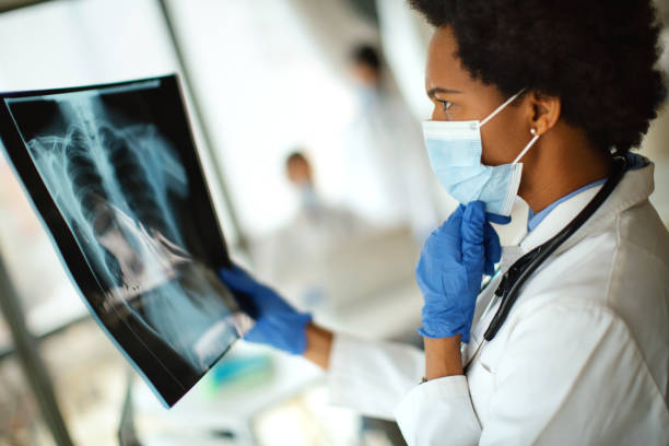 Doctor analyzing an x-ray image of a COVID-19 patient. Doctor analyzing the case of one Covid-19 patient. Medical worker is in protective workwear. severe acute respiratory syndrome stock pictures, royalty-free photos & images