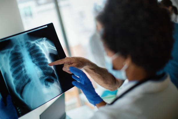 Doctor analyzing an x-ray image of a COVID-19 patient.