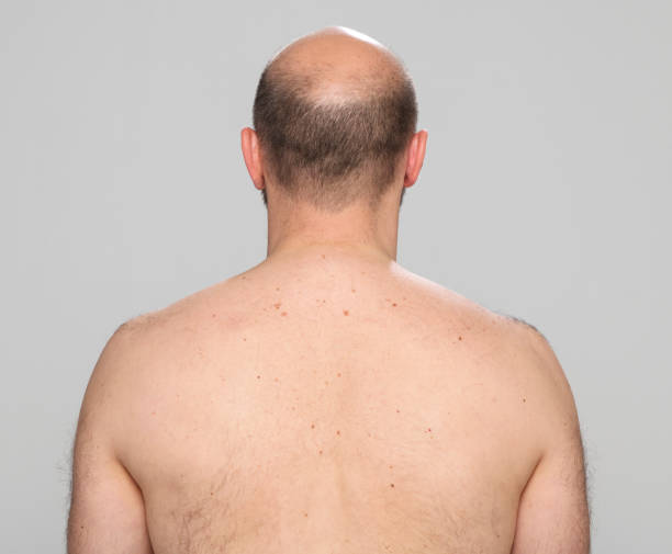 istock Rear view of shirtless mature man 1346122021