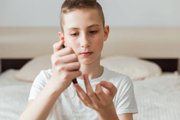 el adolescente toma una muestra de sangre para la diabetes con pluma lanceta. concepto de salud, medicina y diabetes - diabetes blood sugar test insulin healthy eating fotografías e imágenes de stock