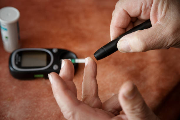 puncturing finger with lancet for measuring blood sugar with glaucometer - glaucometer imagens e fotografias de stock