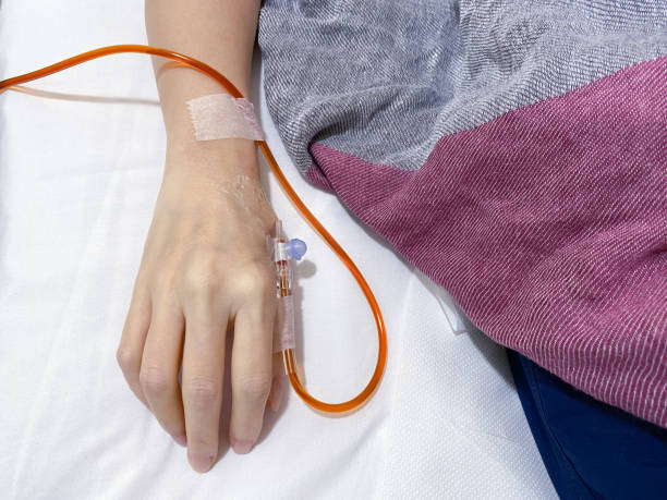 close view of hand connected to intravenous iv iron drip catheter and tube in hospital, for iron deficiency patients - anemia imagens e fotografias de stock