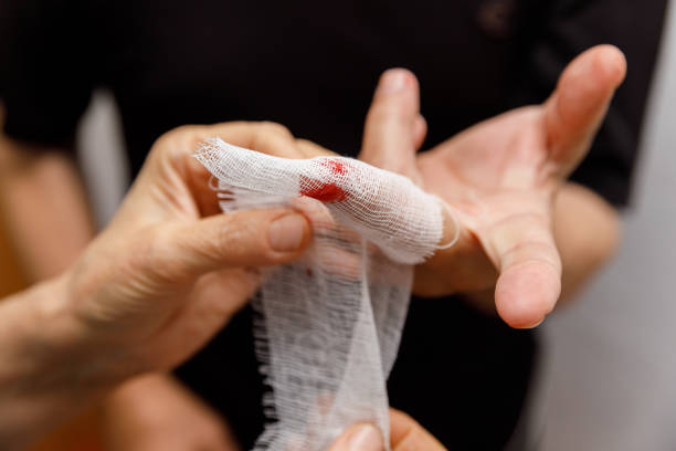 applying a bandage to the wound of a man's finger. the man neglected precautions and cut his hand. domestic trauma. work injury - wound blood human finger human hand imagens e fotografias de stock