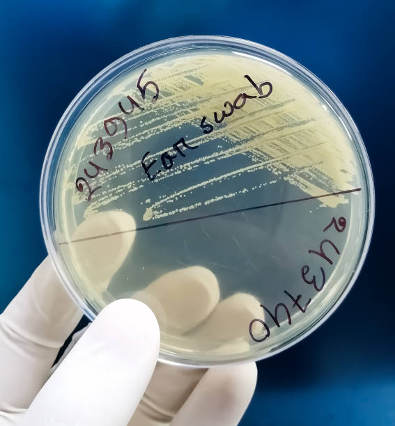 istock Ear swab culture, Microbiology 1346351175