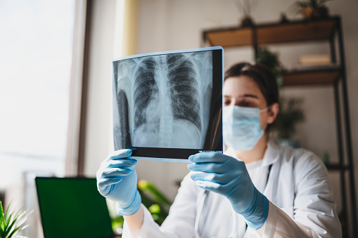 film X-ray show normal chest of infant