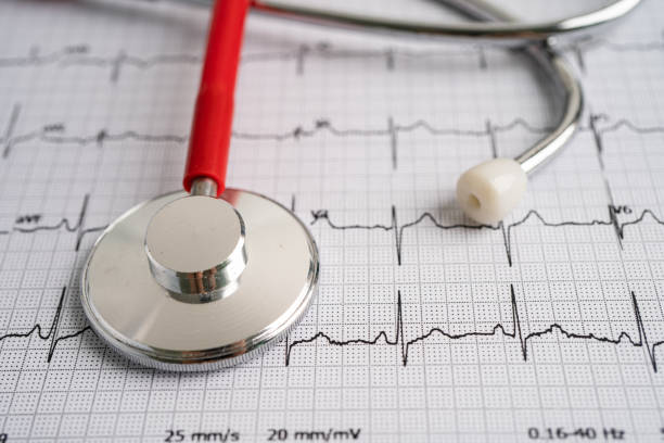 istock Stethoscope on electrocardiogram ECG, heart wave, heart attack, cardiogram report. 1346375455