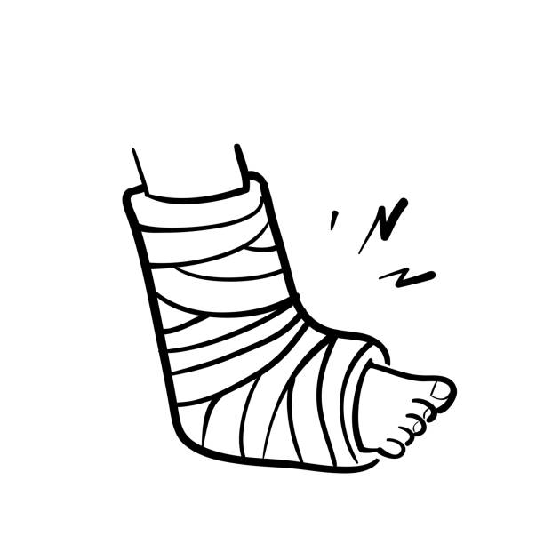 hand drawn doodle broken leg in bandage illustration vector hand drawn doodle broken leg in bandage illustration vector foot cast stock illustrations