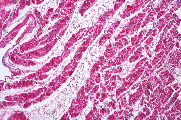istock Light microscope Adiposis of heart pathplogy. 1346440856