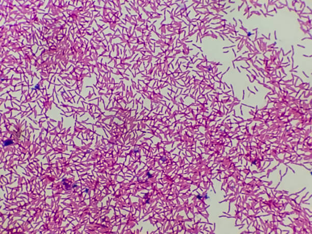 istock Escherichia coli, also known as E. coli, is a Gram-negative, facultative anaerobic, rod-shaped bacterial micrograph. 1346544875