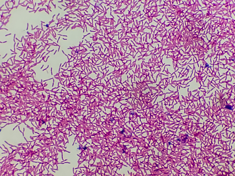 Culture medium bacteria colonies gram stain microscopic 100x image of Escherichia coli, also known as E. coli, is a Gram-negative, facultative anaerobic, rod-shaped, coliform bacteria.