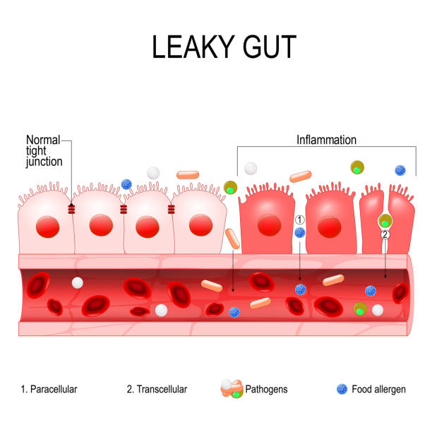 stockillustraties, clipart, cartoons en iconen met leaky gut - lekken