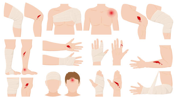 Cartoon physical injury, wound bandage application concept. Open and bandaged human body parts, treated wounds, fractures vector illustration. Human physical injury treatment Cartoon physical injury, wound bandage application. Open and bandaged body parts, treated wounds, fractures vector illustration. Human physical injury treatment. Wound and injury physical accident bandage arm stock illustrations