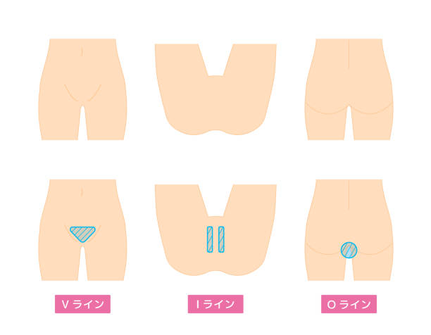 Back Hair Removal Illustrations, Royalty-Free Vector Graphics & Clip Art -  iStock