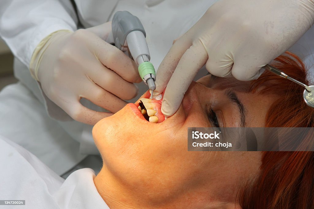 Dentysta w pracy - Zbiór zdjęć royalty-free (Analizować)