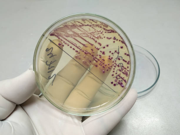 test de culture et de sensibilité avec échantillon d’urine sur hi chrome, milieu de gélose uti au laboratoire de microbiologie médicale. - growing medium photos et images de collection